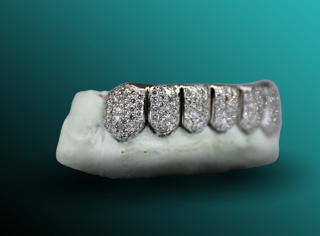 925 Sterling Silver Prong Set VVS Honeycomb Grillz