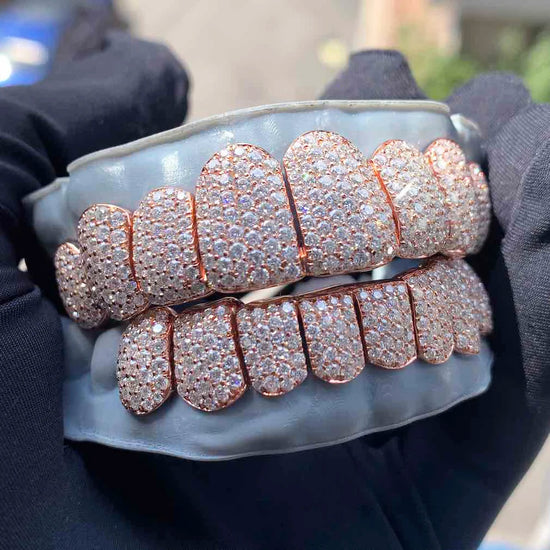 8 on 8 Custom Iced Out Perm Cut Diamond Moissanite Grillz