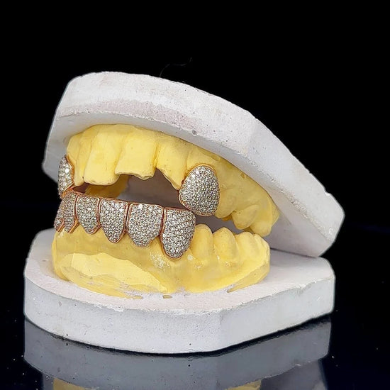 Unique 2 Top & 6 Bottom VVS Moissanite Rapper Diamond Grillz