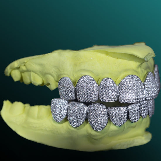 8 on 8 Iced Out VVS Moissanite Diamond Rapper Grillz