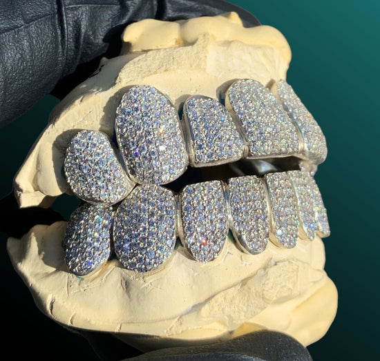 Custom Iced Out VVS Diamond Teeth 925 Silver